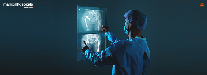 Total hip replacement surgery for pain relief and improved mobility at KMC Hospitals