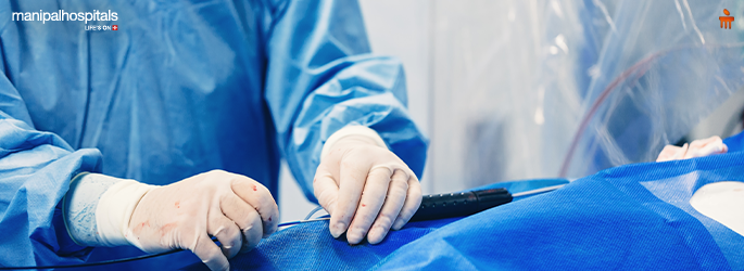 CABG vs Angioplasty: Understanding Differences, When to Choose, and Recovery