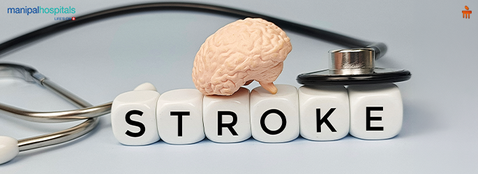How to Recognise and Treat a Brain Blockage (Ischemic Stroke)