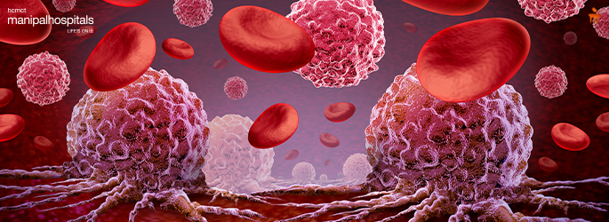 Blood Cancer Symptoms