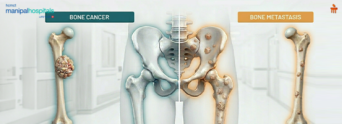 bone cancer symptoms