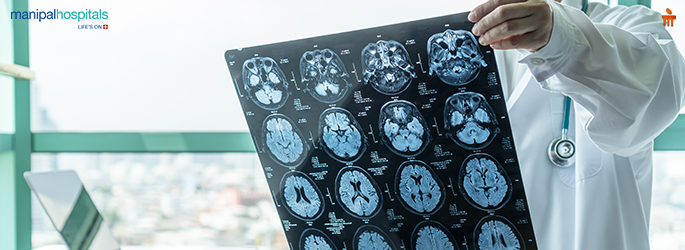 Migraine Treatment: Is Botox Effective for Chronic Migraines?