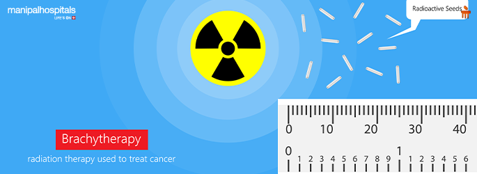 Internal radiation therapy