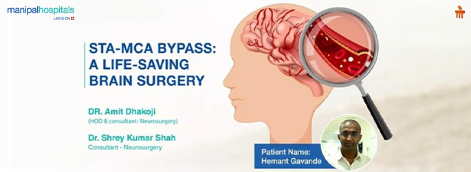 Brain Bypass Surgery for Moya Moya Disease