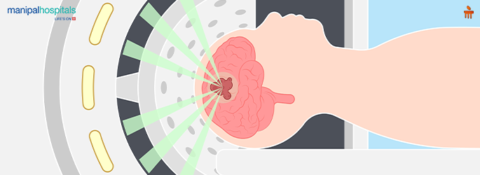 Post-surgery recovery tips