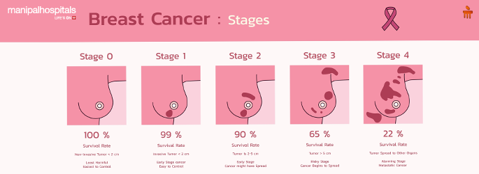 Breast Cancer Surgery
