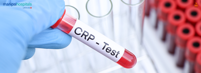 CRP Blood Test: Normal Range, High Levels & Heart Risk Explained