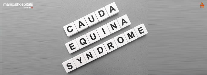 Cauda Equina Syndrome: Causes, Surgery, and Emergency Spine Care