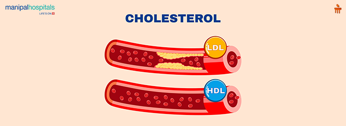 normal cholesterol levels