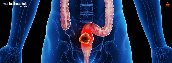 colorectal cancer surgery