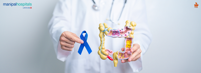 Colorectal Cancer: Early Symptoms, Risk Factors, Stages, and Treatment