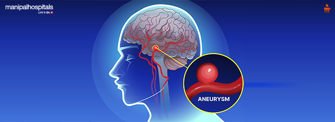 Coma After Brain Aneurysm: Symptoms, Diagnosis & Treatment