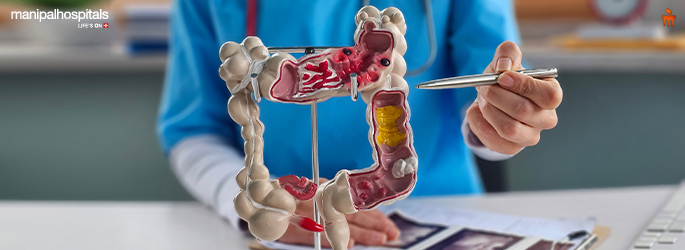 Common Symptoms of Colorectal Cancer: What Your Body May Be Telling You