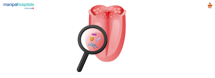 Common Causes of Tongue Pain & When to See a Doctor