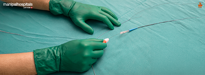 Detailed guide to coronary angiography and patient expectations