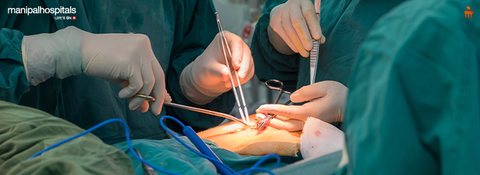 Heart Bypass Surgery: Procedure, Recovery & Care