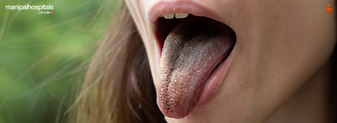 Dark tongue symptoms