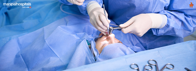 Deviated Nasal Septum (DNS): Symptoms and Septoplasty Recovery