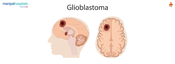  types of tumors