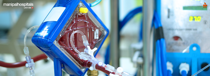 ECMO machine supporting a critically ill patient in an ICU setting