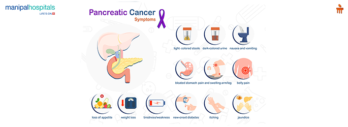 types of pancreatic cancer