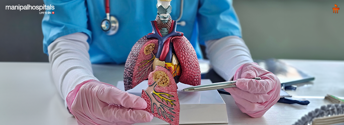Early-Stage Lung Cancer: Why It’s So Hard to Spot the Symptoms