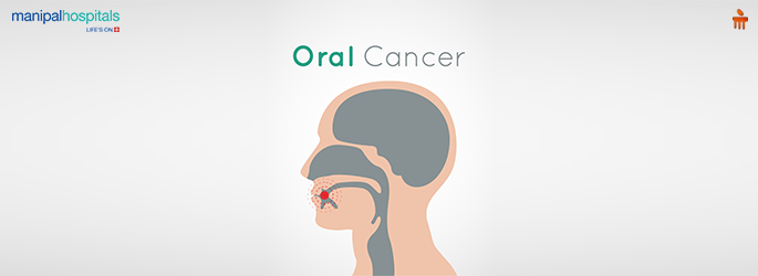 oral cancer symptoms