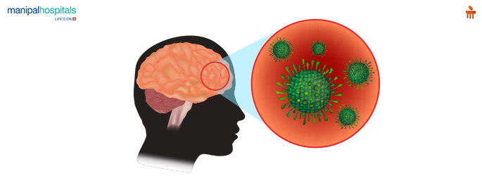 Early symptoms of viral encephalitis