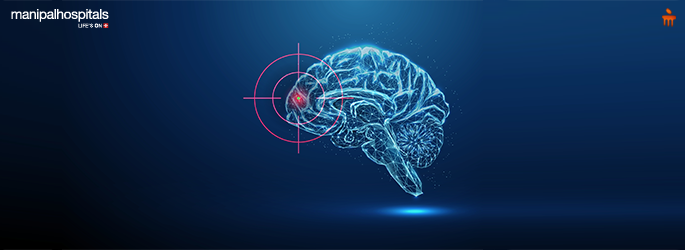 Epilepsy symptoms causes and effective treatments