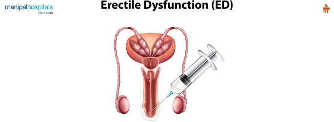 causes of erectile dysfunction