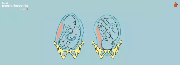 best gynaecologist hospital in Delhi