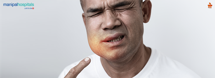 Facial Swelling