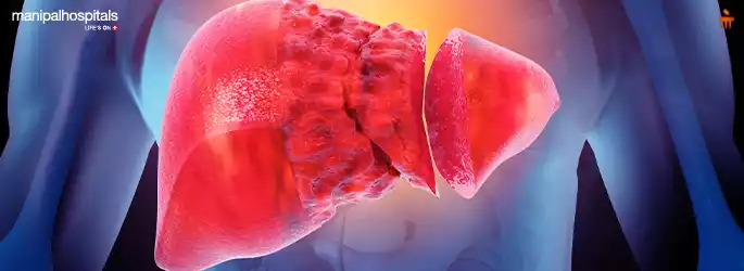 Can a Bad Liver Cause Weight Gain? Shocking Truth Revealed!