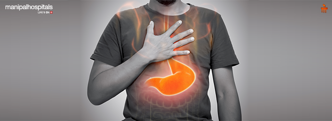 GERD Acid Reflux: Symptoms, Complications, and Treatment