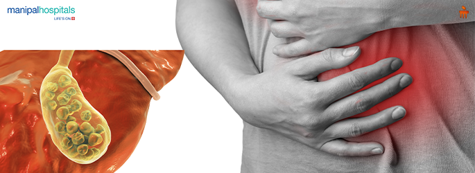 Gallbladder Stone Diagnosis and Surgical Treatment Options