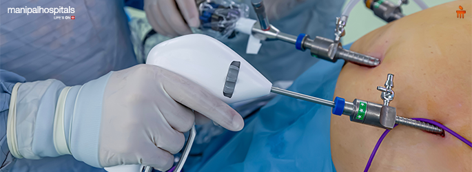 Gastric Bypass Surgery: Types, Causes and Treatment Options