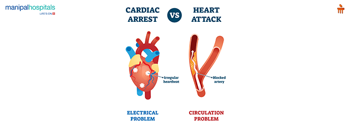 Heart Attack vs Cardiac Arrest: What to Do in the First 10 Minutes