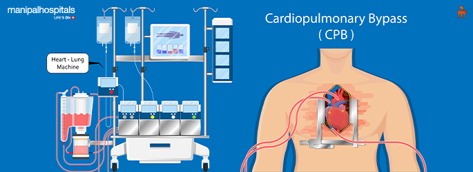 heart lung machine