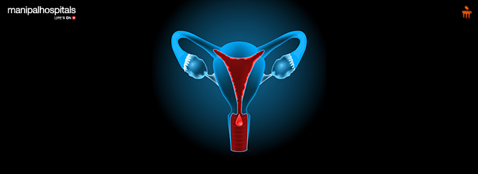 Heavy Periods and Menorrhagia: Causes, Symptoms, and Treatment Options
