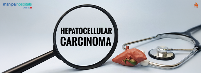 Hepatocellular Carcinoma HCC: Meaning, Symptoms & Treatment Options