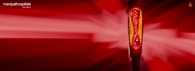 High cholesterol causes, risks and warning signs