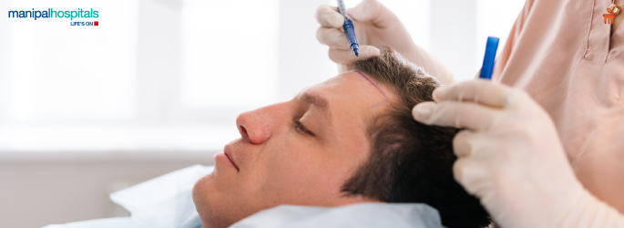 Hair Transplantation Clinic: Tips to Choose the Best One!
