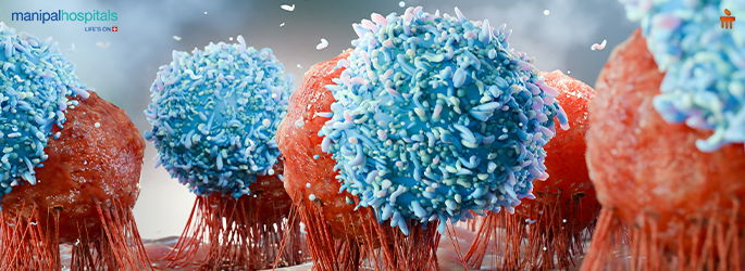 colorectal cancer surgery