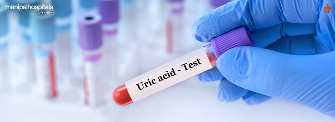 Uric Acid Treatment