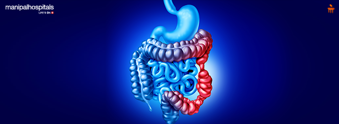 IBS treatment diet medication and lifestyle tips