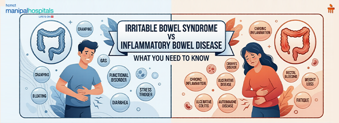 irritable bowel syndrome  