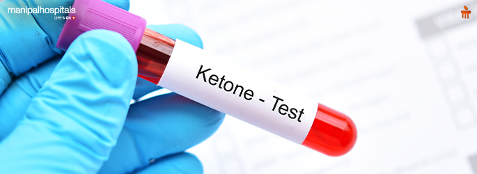 Ketones in Urine