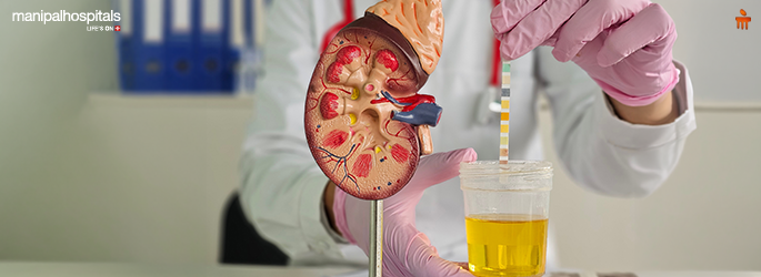 Kidney Profile Test
