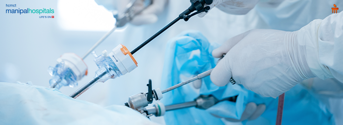 Laparoscopic Appendectomy