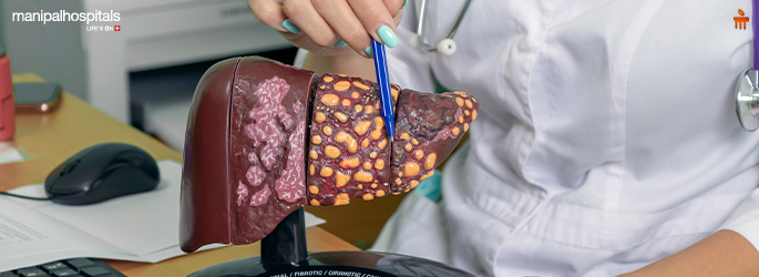 Stage 4 liver cancer risks